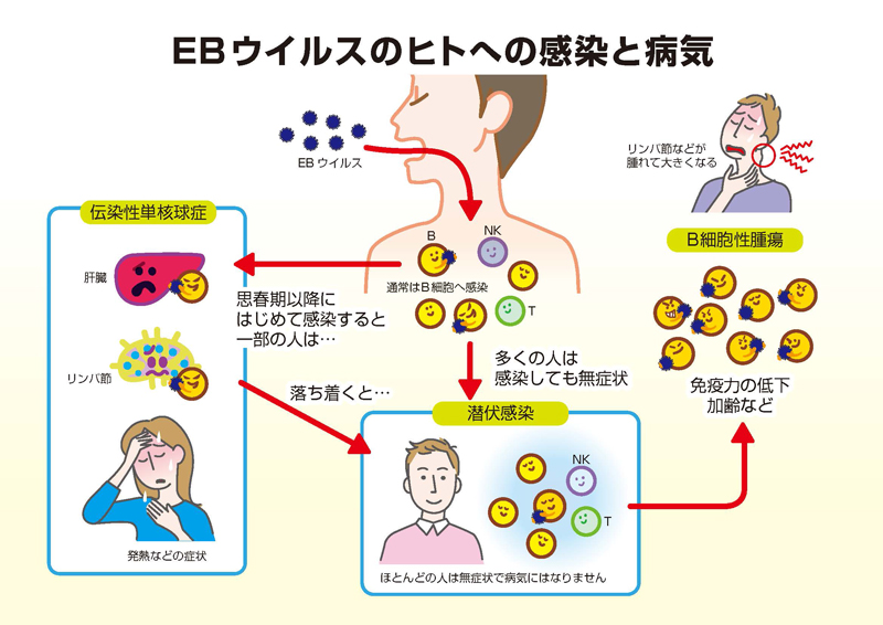 ウイルス eb