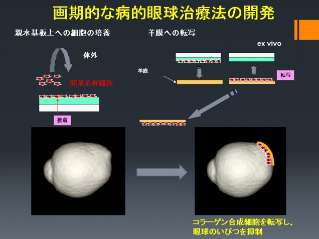 印刷技術を応用した病的眼球治療法の開発