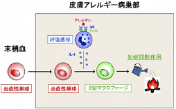 アレルギーを抑える新たな仕組みを発見