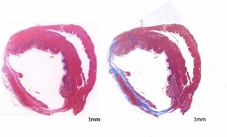 ラット心筋梗塞モデル（左：HE染色、右：アザン・マロリー染色）：左室壁の菲薄化と線維化がみられる。
