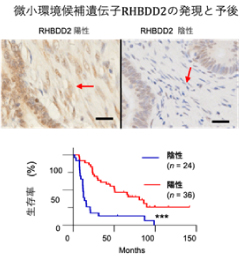 微小環境候補遺伝子RHBDD2の発言と予後