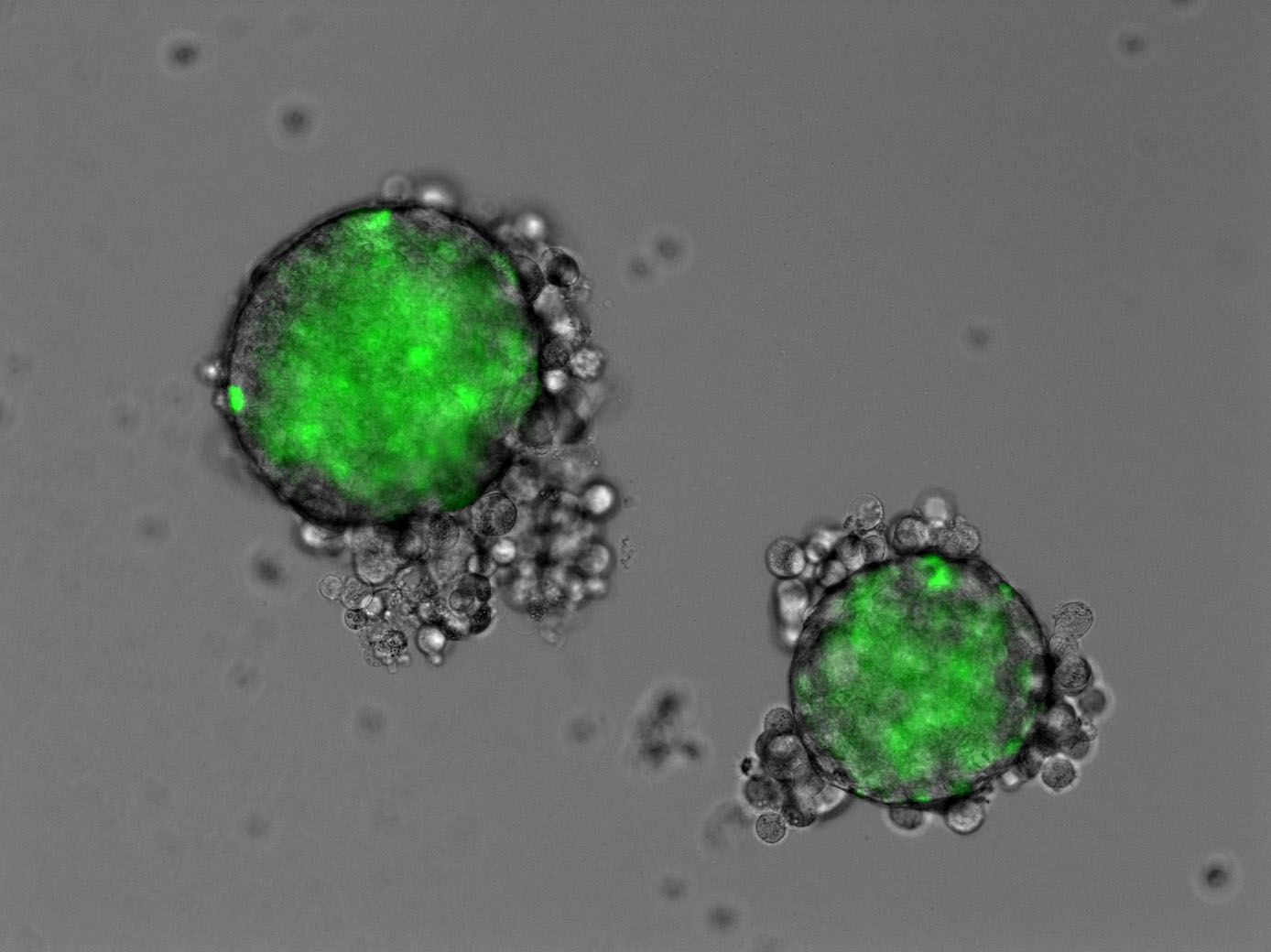 緑色蛍光を示す膵癌幹細胞のスフェロイド形成の観察
