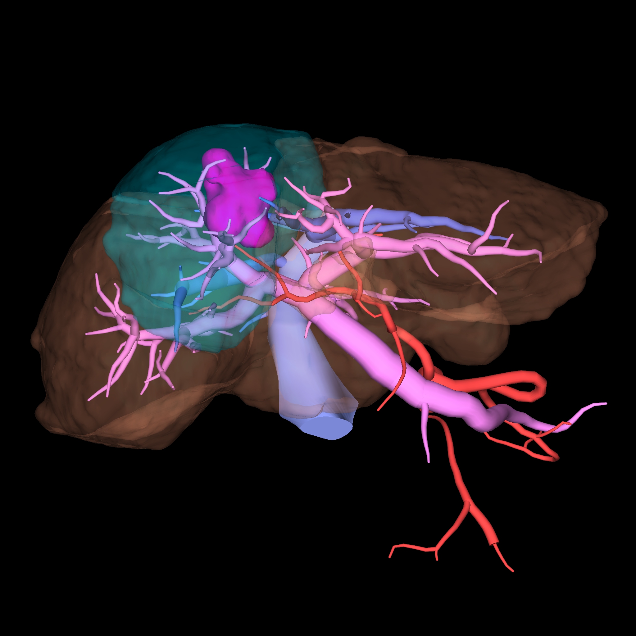 肝臓の脈管解剖を術前のCT、MRI画像から三次元再構成して、手術のシミュレーションとして活用しています。