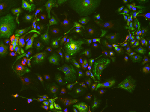 １つの肝幹細胞に由来する肝細胞（赤）と胆管細胞（緑）