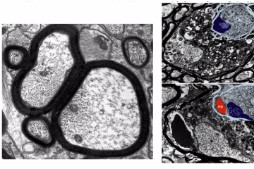 細胞質性蛋白質輸送変調による遅発性軸索変性（マウス視神経）