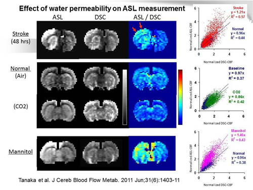 動物用MRIを用いた、虚血モデルラットのALS法による脳循環評価