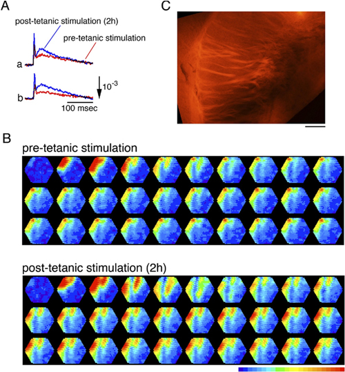 ラット脳スライスでの光学イメージングによる皮質線条体回路の研究