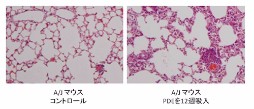 鳩糞抽出物(PDE)吸入による慢性過敏性肺炎マウスモデル。