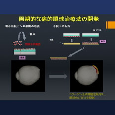 3D MRI画像解析による「病的近視」の原因解明